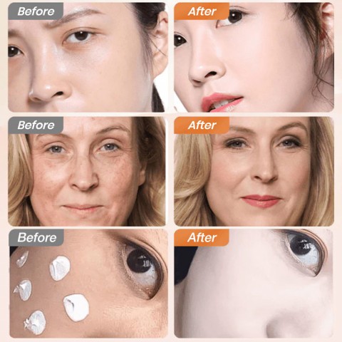 5-in-1 Anti-wrinkle Cream