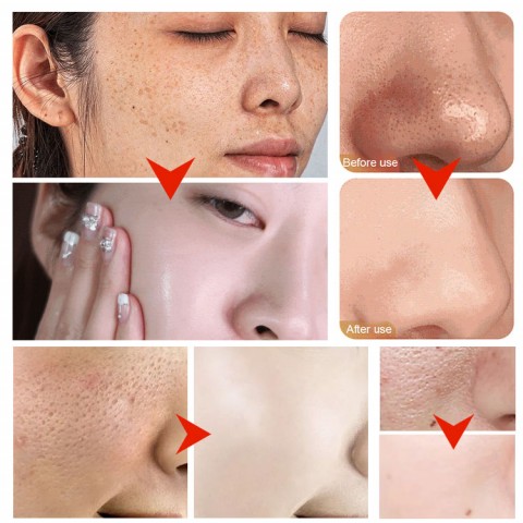 Centella Bubble Mask