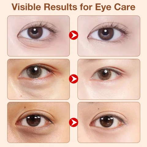 Collagen Absorbable Eye Masks