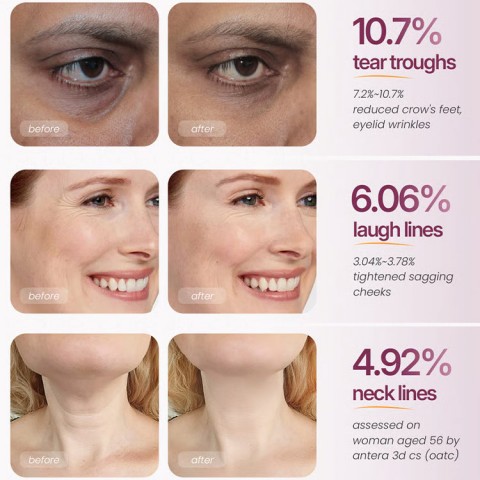 Cementrete Calcium Multi Balm Eye Cream Stick