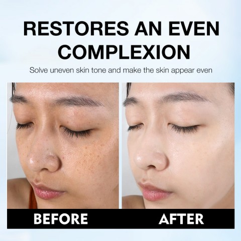 Dark Spot Treatment Lotion