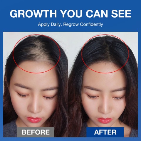 Hair Roll-On Serum