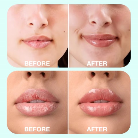 Lip serum Plump and moisturizing lip oil