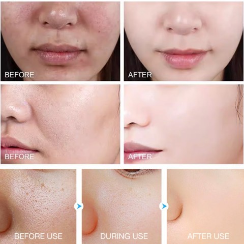 Purifying Enzymes Exfoliating Gel