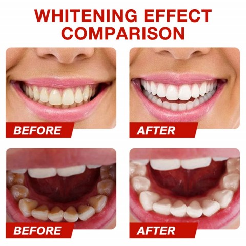 Sp8 Probiotic Refreshing Toothpaste