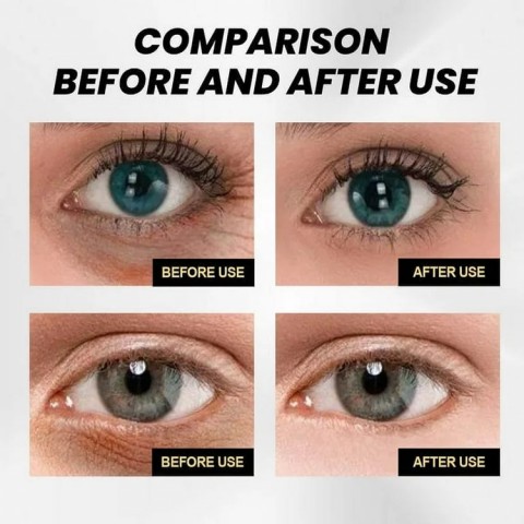 Buy One Get One Free Vitamin C Eye Cream! 