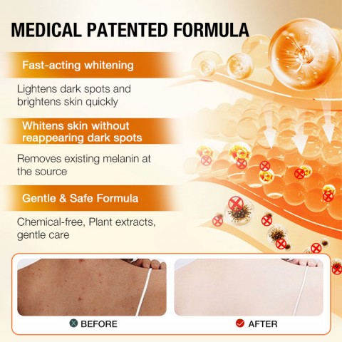JaniceJo Lemon Kojic Acid Turmeric Whitening Soap Bar for Face and Body