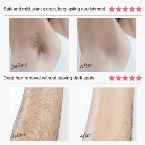  Hair Removal Cream