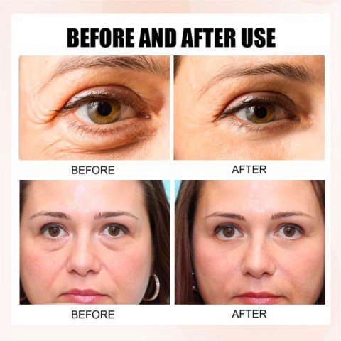 Anti-Wrinkle Eye Serum