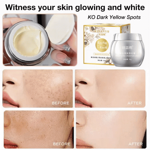 Whitening and anti-freckle cream