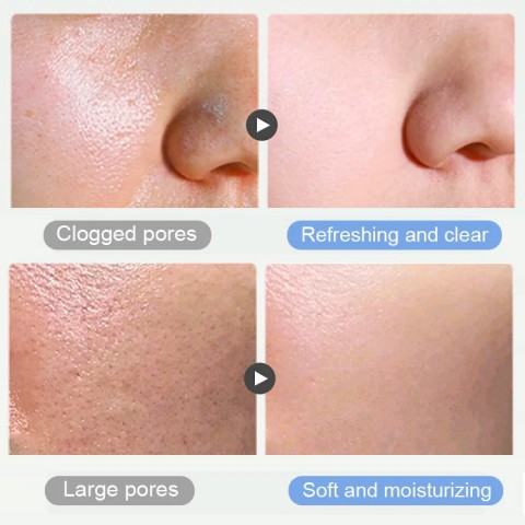 Cleansing mud mask-Shrink pores and remove blackheads