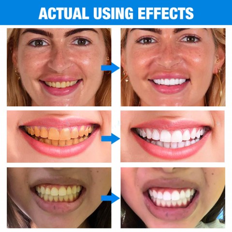 Teeth Whitening Essence